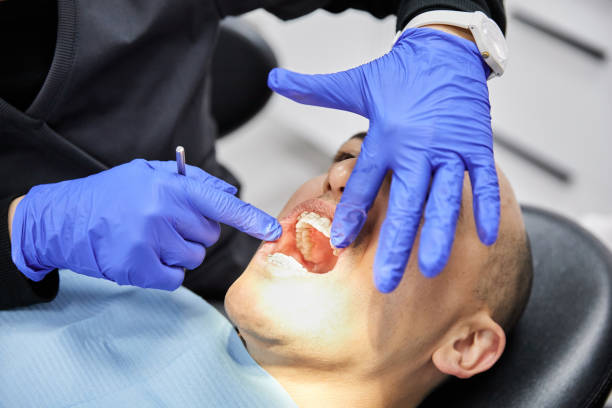 Best Emergency Dentist for Lost Fillings or Crowns in Lanai City, HI